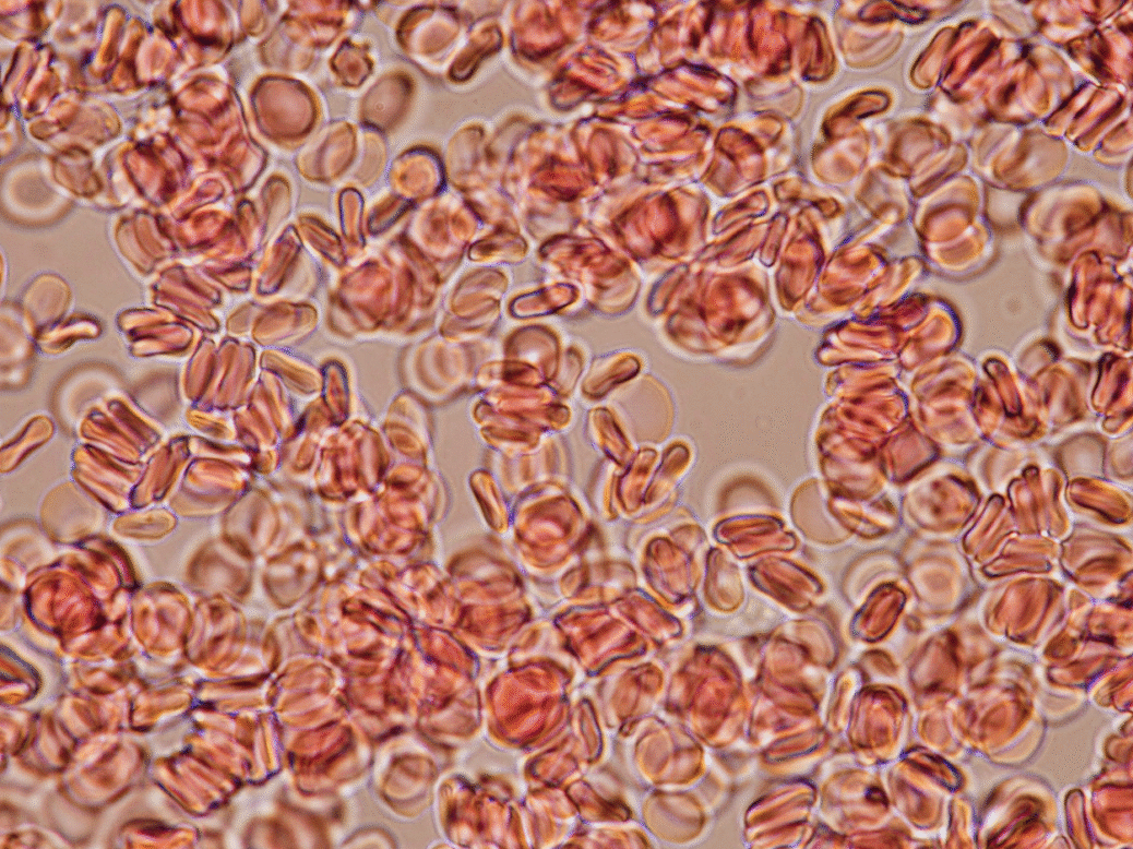 Human blood under a microscope, at the centre of a booming — and still speculative — longevity industry